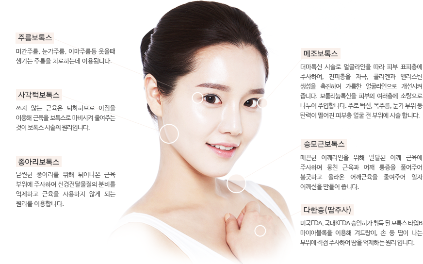 보톡스