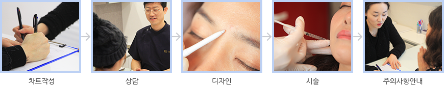 보톡스