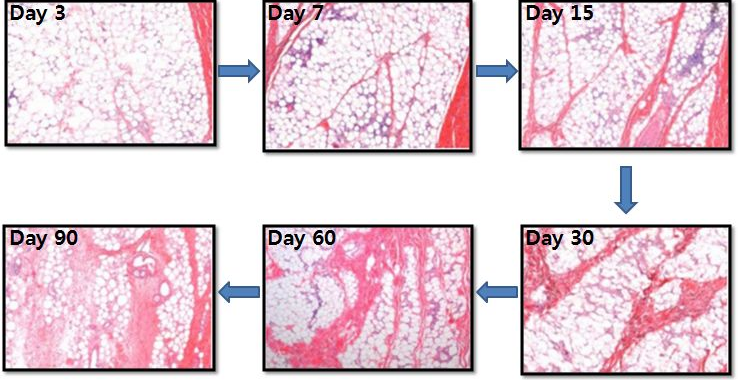Day 3, Day 7, Day 15, Day 30, Day 60, Day 90 조직 변화 이미지