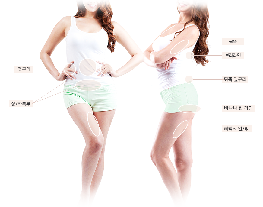 앞면과 뒷면의 옆구리, 상·하복부, 팔뚝, 브라라인, 뒤쪽 옆구리, 바나나 힙 라인, 허벅지 안·밖 시술부위