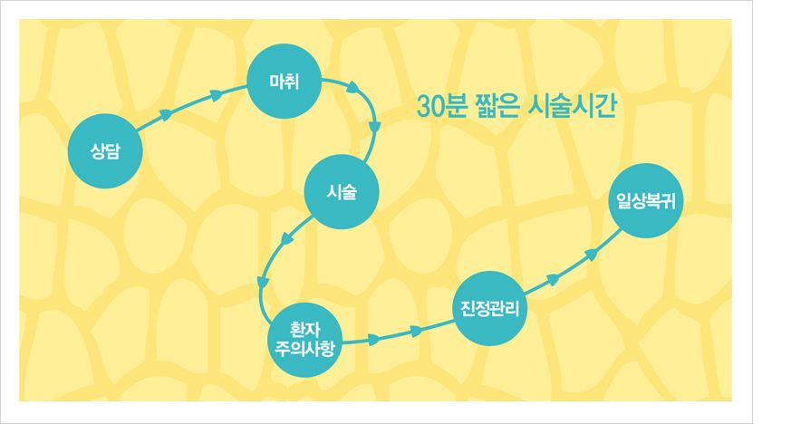 민트 리프팅