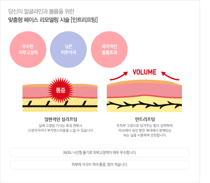 민트 리프팅