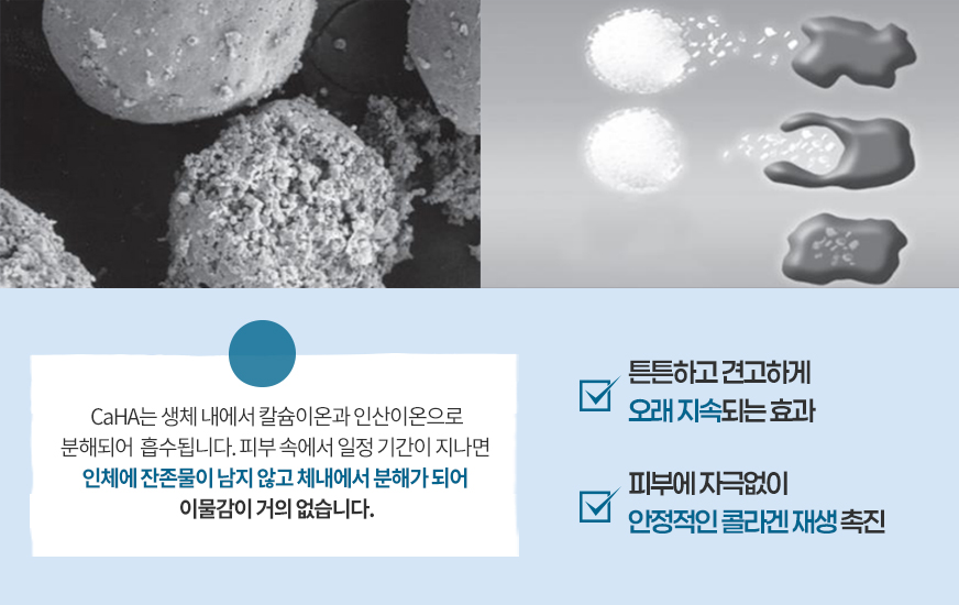 레디어스 CaHA 입자와 체내 분해 과정을 보여주는 기존 자료 이미지