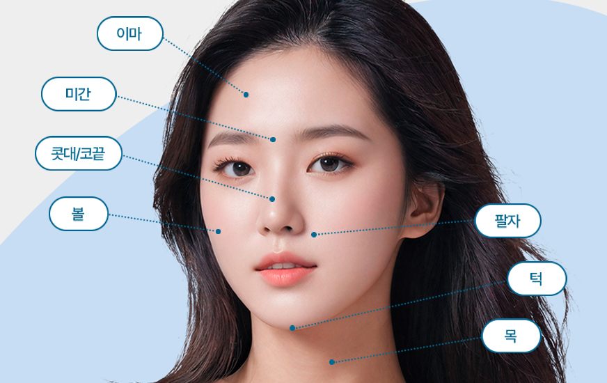 레디어스