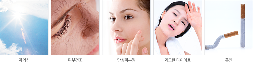 V라인 리프팅